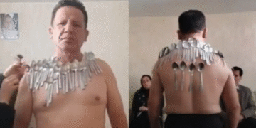 Nuevo récord mundial: hombre logra fijarse 96 cucharas en el cuerpo